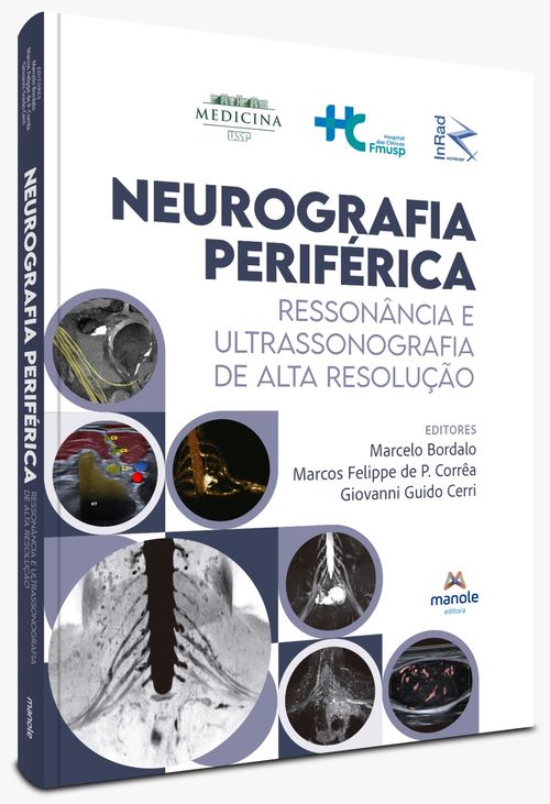 Neurografia Periférica - 1ª Edição Ressonância e ultrassonografia de alta resolução