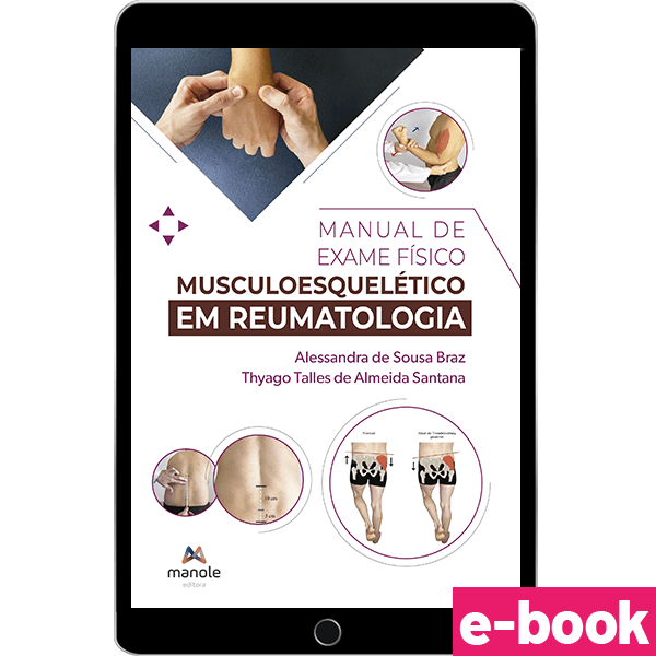 Manual-de-Exame-Fisico-Musculoesqueletico-em-Reumatologia---E-book