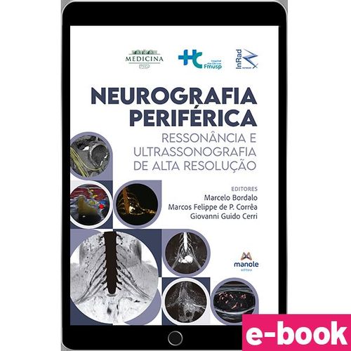 Neurografia Periférica - 1ª Edição Ressonância e ultrassonografia de alta resolução - Ebook