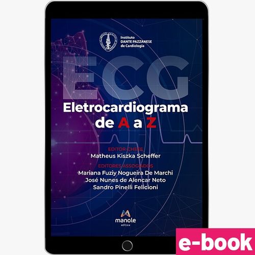 Eletrocardiograma de A a Z - 1ª Edição - Ebook