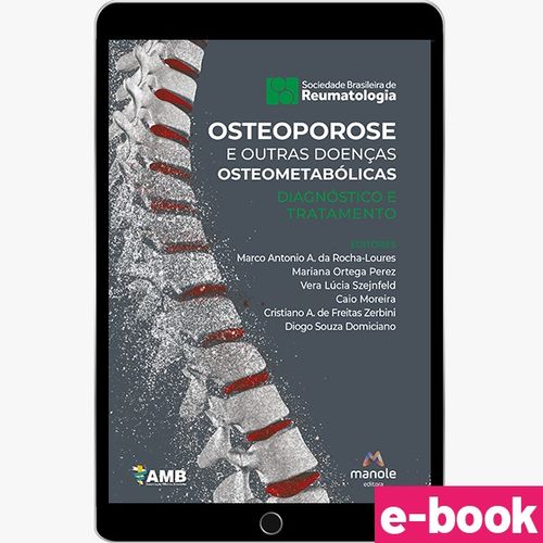 Osteoporose e Outras Doenças Osteometabólicas - 1ª Edição - Ebook