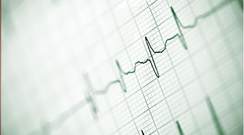 Eletrocardiograma Para Enfermeiros