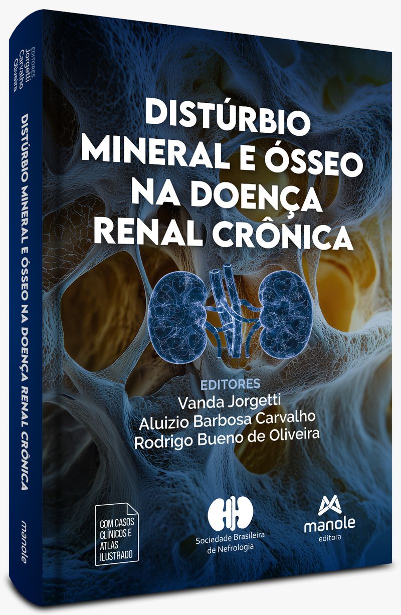 Disturbio-mineral-e-osseo-na-doenca-renal-cronica-1-Edicao
