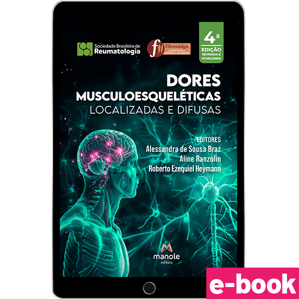 Dores-Musculoesqueleticas-Localizadas-e-Difusas---4ª-Edicao-ebook