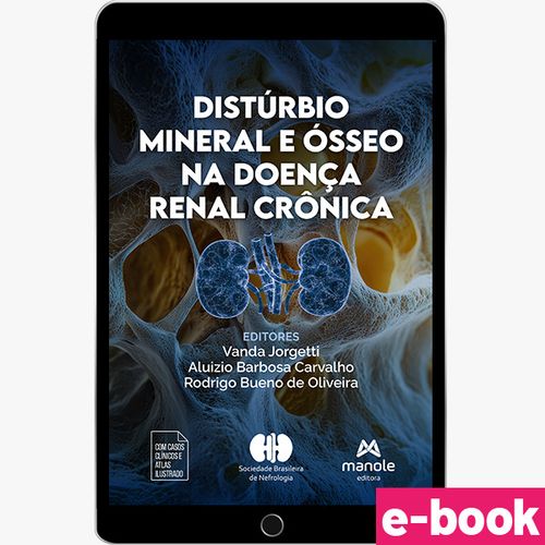 Distúrbio Mineral e Ósseo na Doença Renal Crônica - 1ª Edição - Ebook