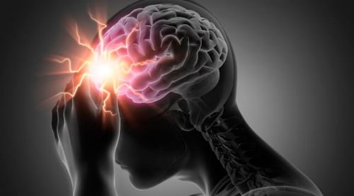 Acidente Vascular Cerebral