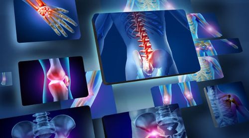 Síndromes Dolorosas: Cefaleia, Dor Neuropática, Lombalgia, Cervicalgia, Osteoartrite