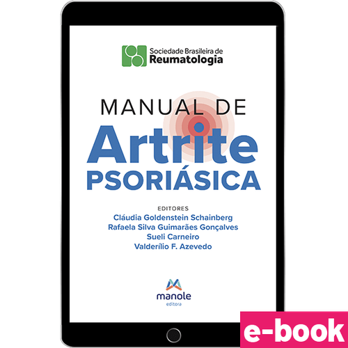Manual de Artrite Psoriásica: Diagnóstico e tratamento - 1ª Edição- Ebook