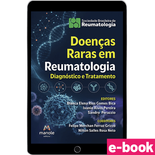Doenças Raras em Reumatologia: Do diagnóstico ao tratamento - 1ª Edição - Ebook