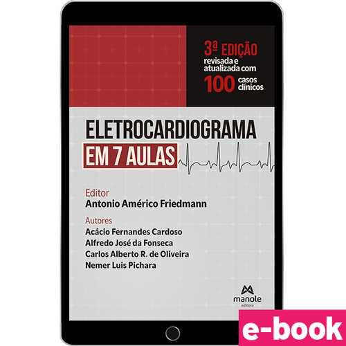 Eletrocardiograma em 7 Aulas: Revisada e atualizada com 100 casos clínicos - 3ª Edição - Ebook